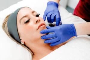 Dermal Fillers